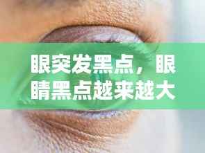 眼突发黑点,眼睛黑点越来越大